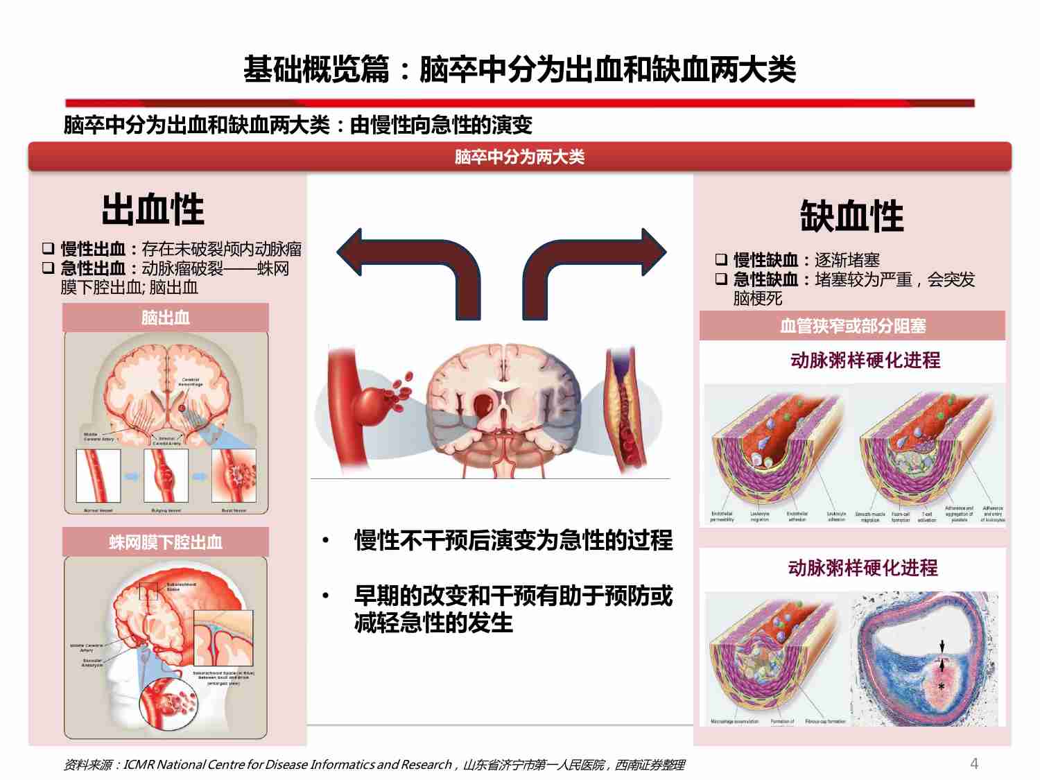 创新器械专题：神经介入-从脑卒中看神经介入器械投资图谱 20240418 -西南证券.pdf-4-预览